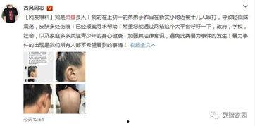 小美弟弟爆料视频全集免费观看,揭秘背后惊人真相  第2张